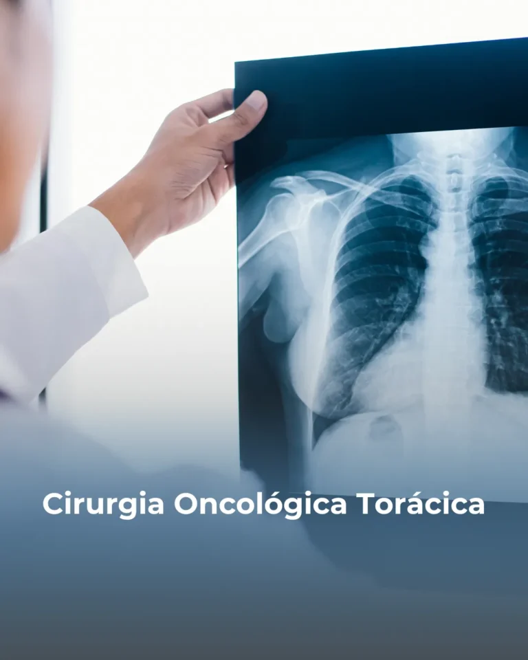 ✔️ Ressecção de tumores pulmonares ✔️ Cirurgia para câncer de esôfago ✔️ Tratamento cirúrgico de tumores mediastinais