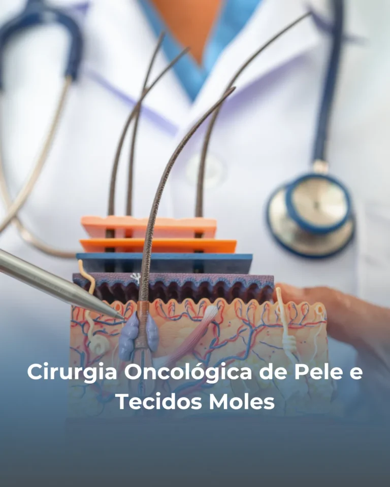 ✔️ Remoção de melanoma e câncer de pele ✔️ Ressecção de sarcomas de partes moles ✔️ Reconstrução cirúrgica pós-ressecção