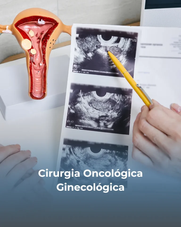 ✔️ Cirurgia para câncer de ovário ✔️ Ressecção de tumores uterinos e cervicais ✔️ Tratamento cirúrgico para câncer de vulva